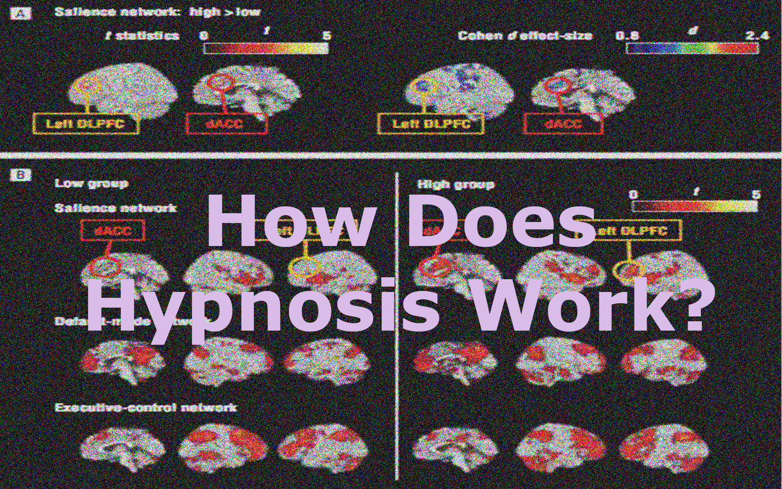 do hypnosis work